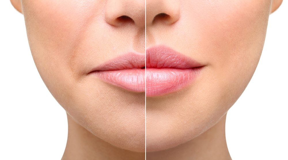 The Fascinating World of Dermal Fillers: 8 Common Questions for Injectors